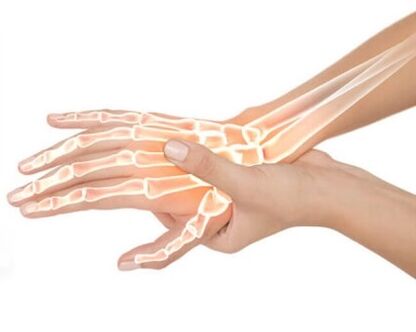 A Hondrox-et az érintett területre kell alkalmazni