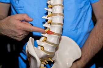 Miért fáj a hát a hát alsó részén, és mit kell tennie