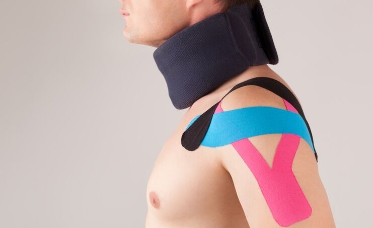 A nyaki osteochondrosis akut időszakában speciális gallért kell viselni